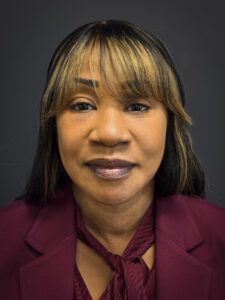 Facelift-Lower-Blepharoplasty-Case--6866 | After Facelift 1