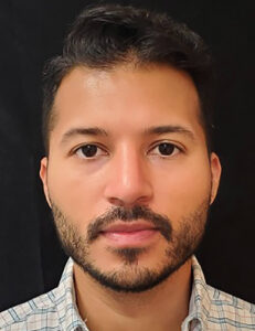 Rhinoplasty-Case--379 | After Rhinoplasty for Men 1