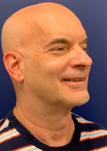 Case--22080 | After Neck Lift 2