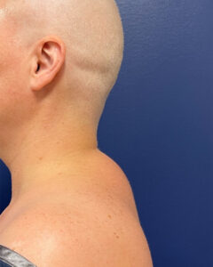 Case--9534 | Before Dr. Frank Albino 1