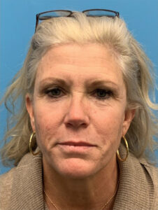 Case--15055 | Before Face360 1