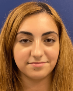 Case--23921 | Before Rhinoplasty 1