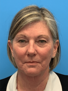 Case--22069 | Before Face360 1