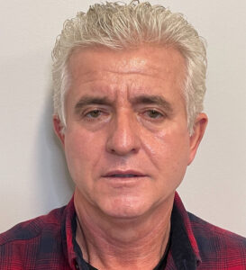 Case--291 | Before Facelift for Men 1