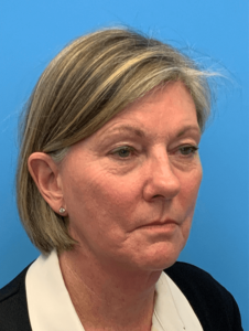 Case--22069 | Before Face360 2