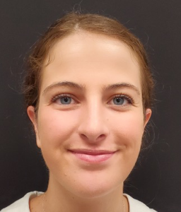 Rhinoplasty-Case--381 | After Rhinoplasty 1