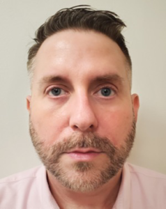 Blepharoplasty-Case--359 | After Eyelid Surgery 1