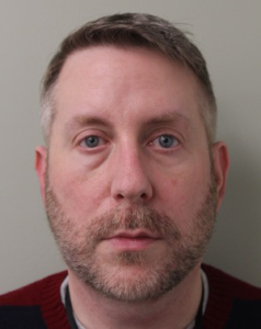 Blepharoplasty-Case--359 | Before Eyelid Surgery 1